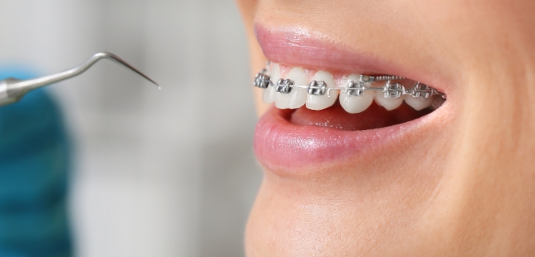 Gentle and Expert Care from a Pediatric Dentist Chembur