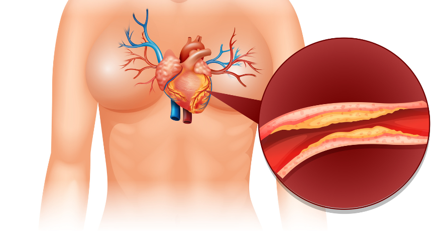 The Non-Invasive Insight: A Patient’s Guide to Seeing Inside the Heart