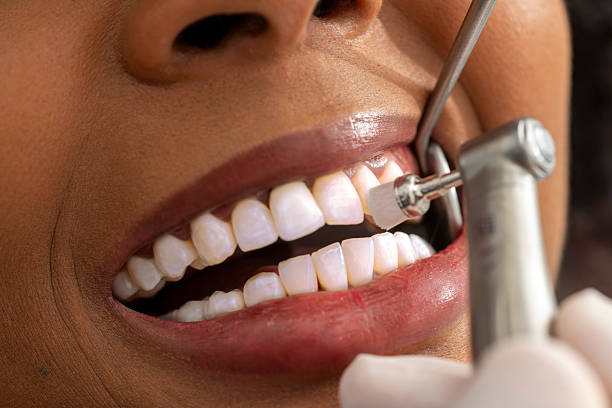 Santa Clarita Trusted Dentist for a Healthier, Brighter Smile