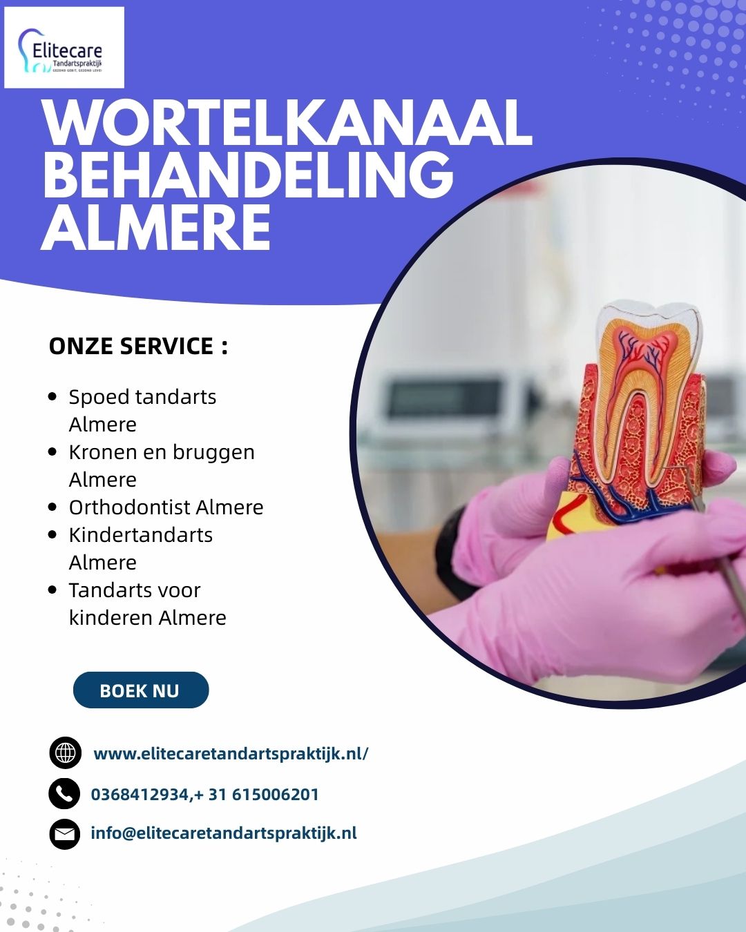 Hoe zorgt u voor uw gebit na een wortelkanaal behandeling Almere?