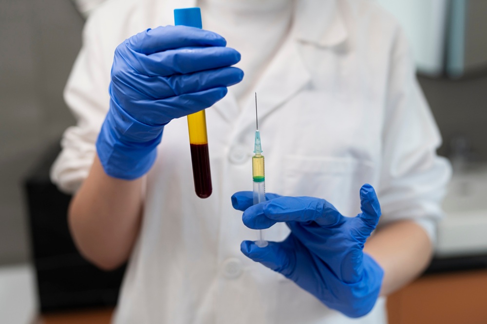 The Role of PRP Treatment for Fertility in Improving IVF Outcomes