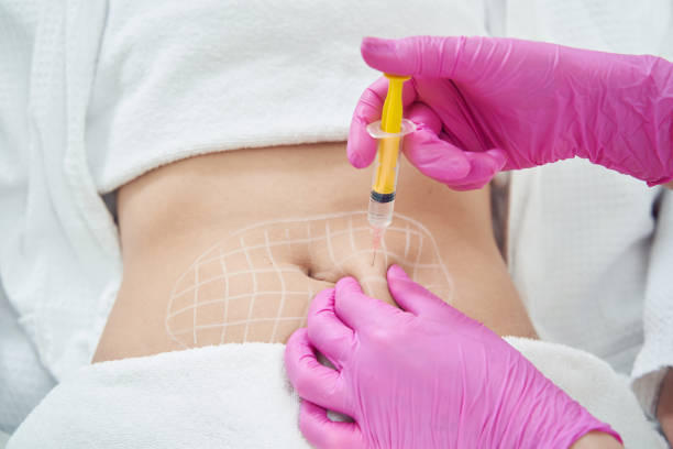 Sculpt Your Profile: The Best Fat Melting Injection in Riyadh