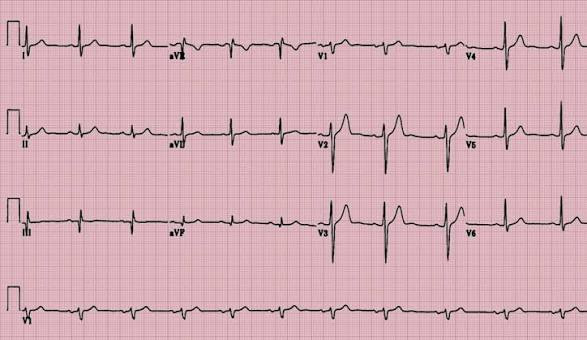 What To Look for Before You Enrolling  In EKG Course Online