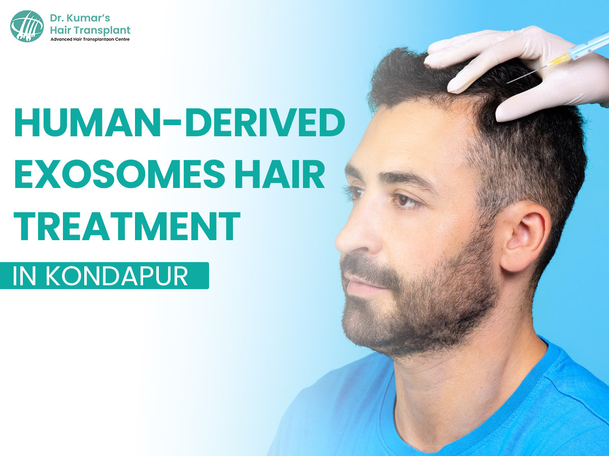 Tired of Hair Thinning? Here's Why Exosome Therapy Is Becoming a Popular Choice