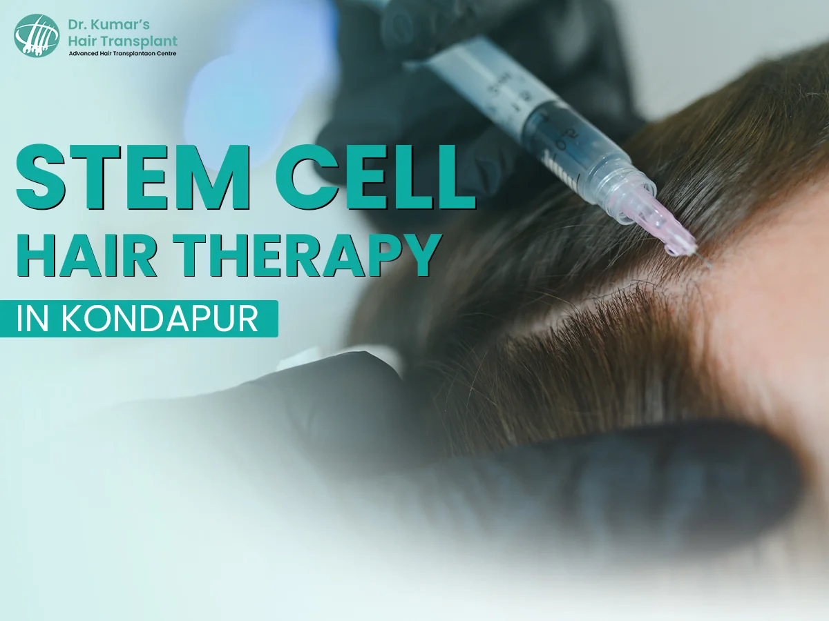 Stem Cell Hair Therapy: A New Hope for People Dealing with Hair Loss