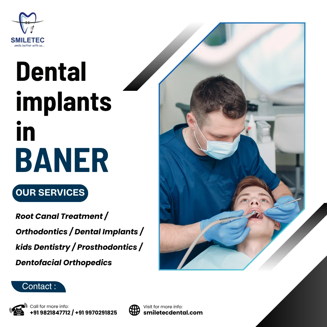 Achieve a Confident Smile with Expert Dental Implant Care in Baner