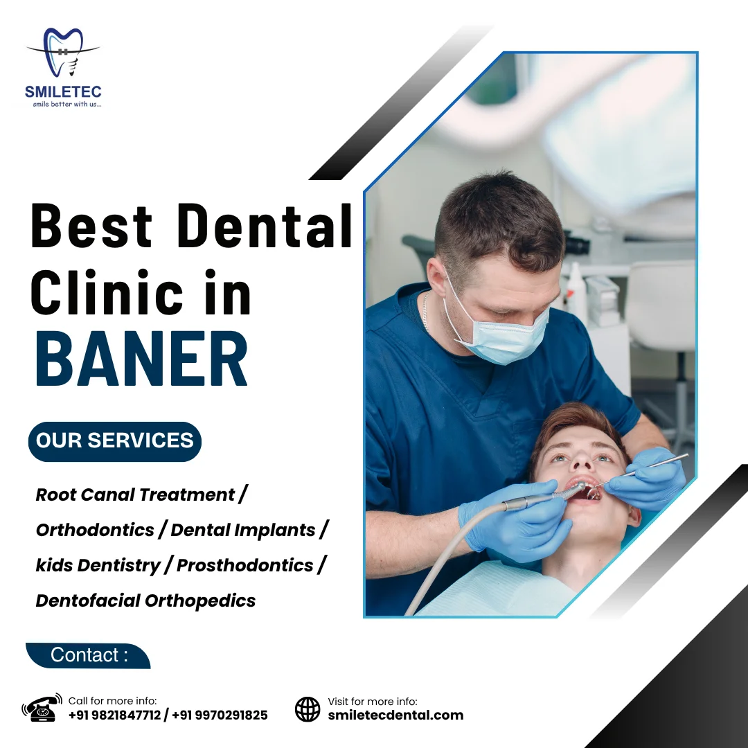 Best Dental clinic Treatment in Baner for a Perfect Smile Transformation