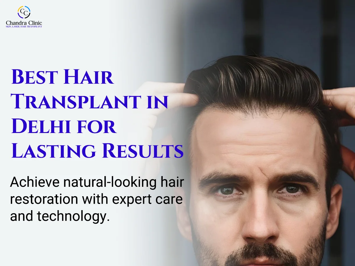 Why Hair Transplant Has Become a Trusted Solution for Hair Loss in Delhi