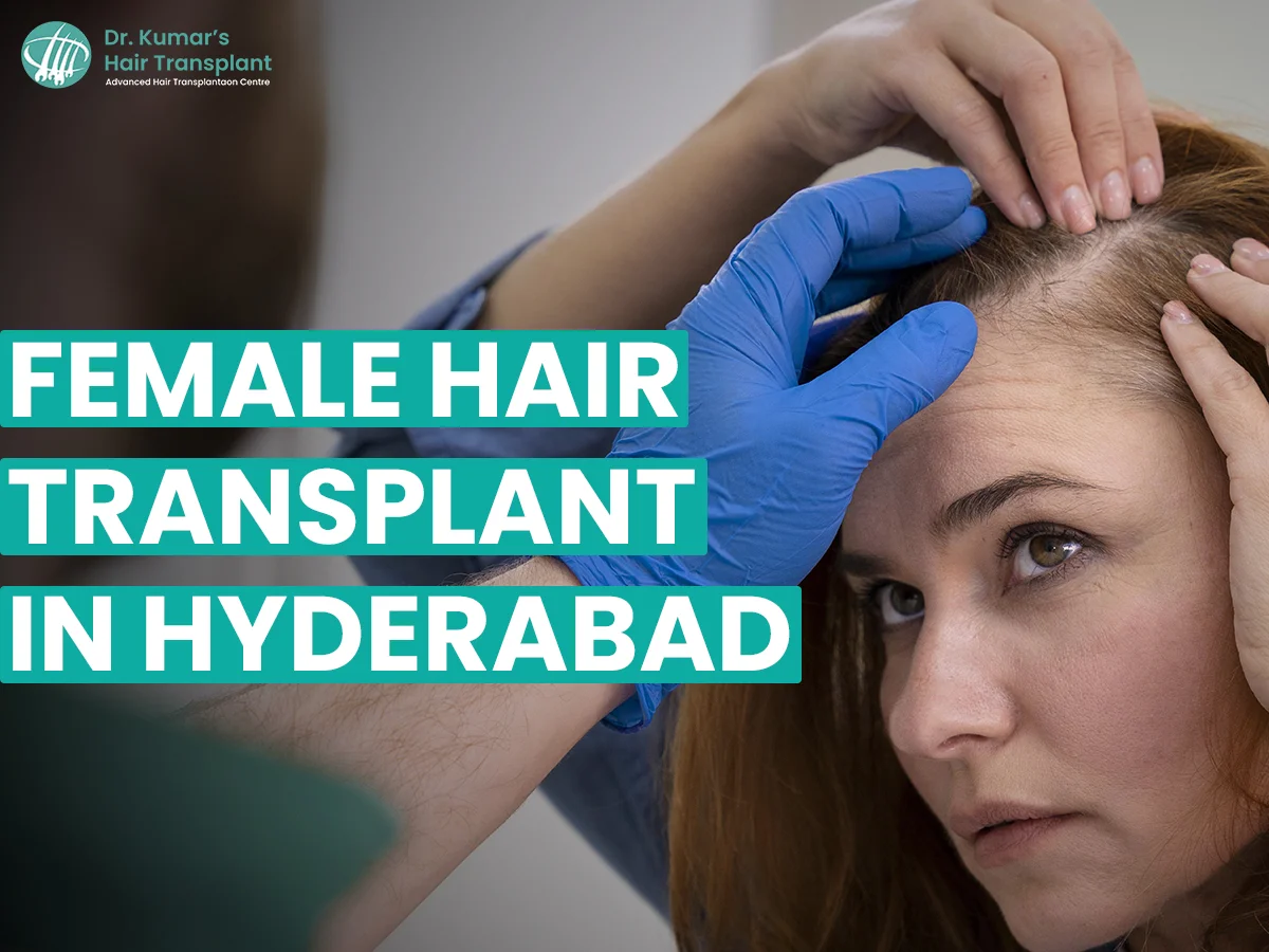 Hair Loss in Women and the Rise of FUE: What Every Patient Should Know