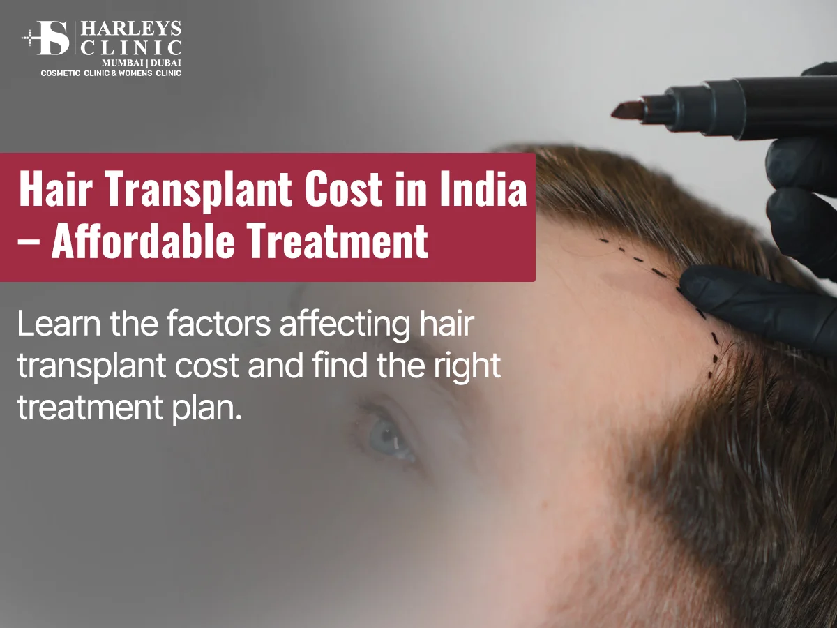 Hair Transplant in India: What Patients Should Know Before Treatment