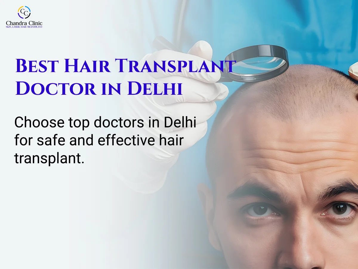 How to Choose the Right Hair Transplant Doctor in Delhi