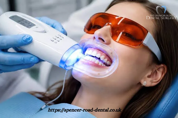 Dental Implants Coventry: A Complete Guide to Replacing Missing Teeth