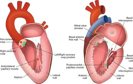 How Can You Tell When an Irregular Heartbeat Needs Advanced Treatment?