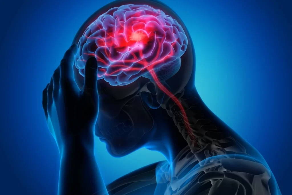 How Doctors Diagnose the Cause of an Occipital Headache