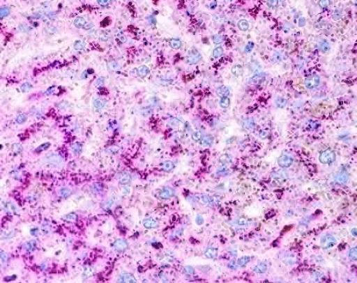 ATG5 and the Machinery of Autophagy: A Researcher's Guide to Detection