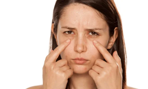 thermage eyelid tightening