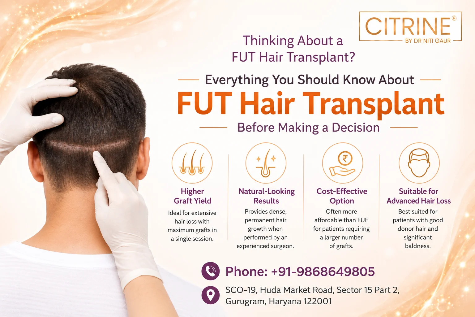 Everything You Should Know About FUT Hair Transplant Before Making a Decision