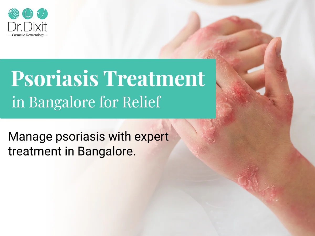 Psoriasis on the Scalp: Symptoms, Causes and Treatment Options