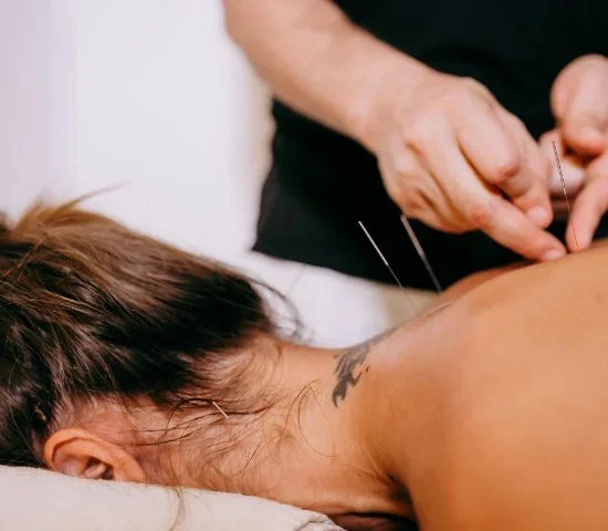Why Dry Needling Physiotherapy Is Helping More People Recover from Persistent Muscle Pain in Gurgaon