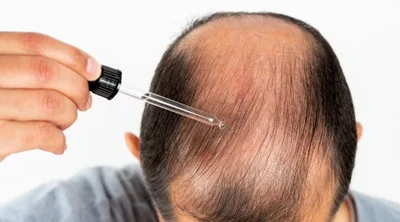 Hair Fall Treatment Dubai: Understanding the Causes and How PRP Hair Restoration May Help