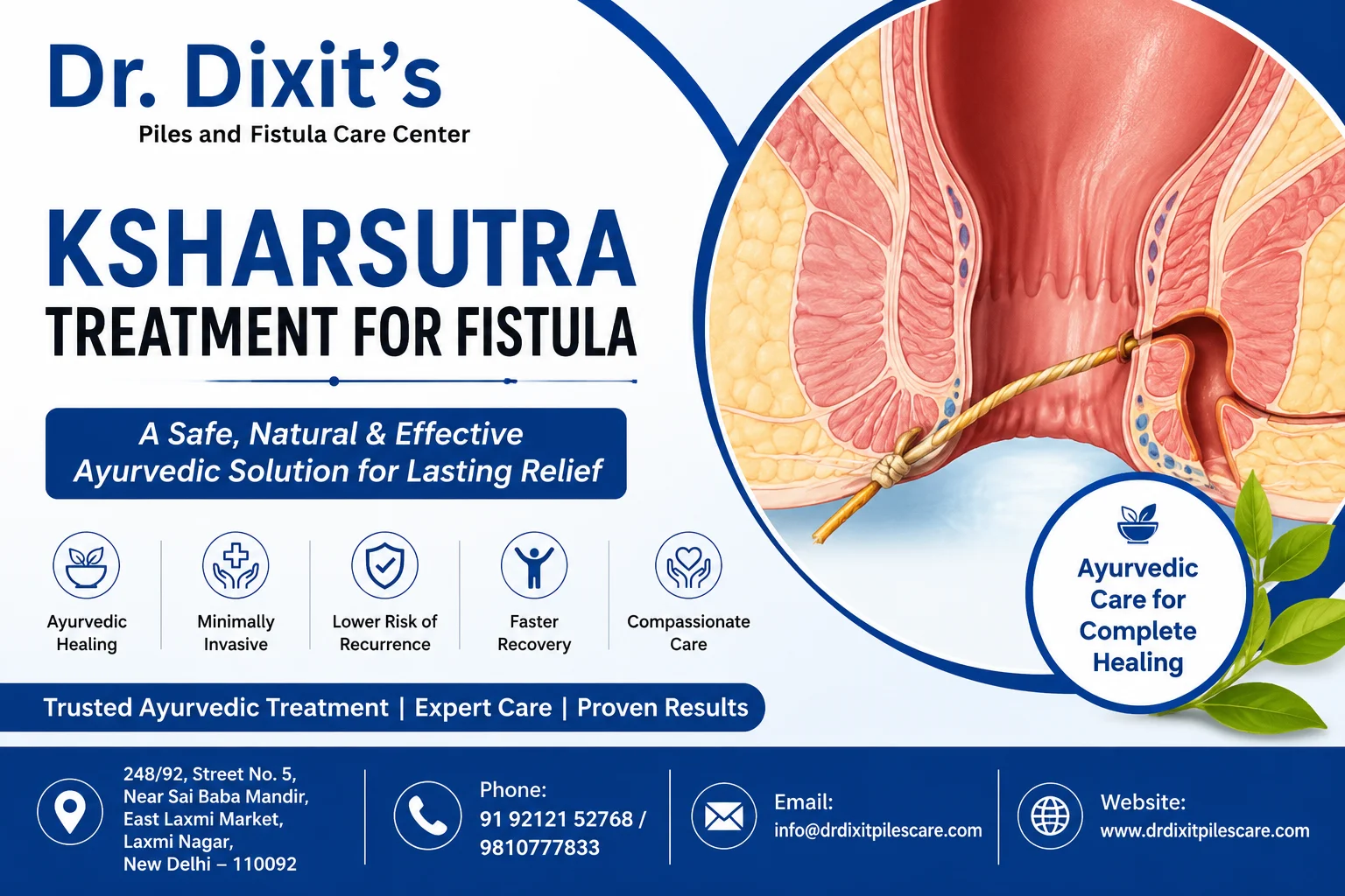 Ksharsutra Treatment for Fistula: A Safe and Effective Ayurvedic Solution for Lasting Relief