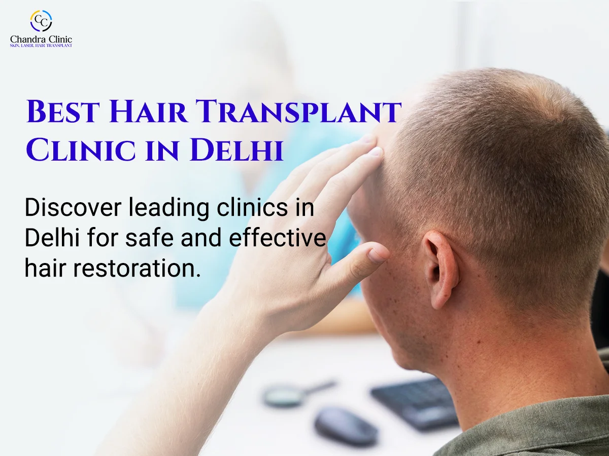 Choosing the Right Hair Transplant Surgeon in Delhi: A Simple Guide for Patients