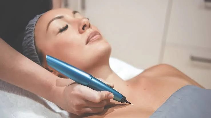 Where Can Cryopen Treatment Kent Make The Biggest Difference To Your Skin?