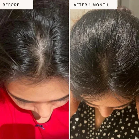 Hair Thinning: The Small Changes You Notice Before Anyone Else Does