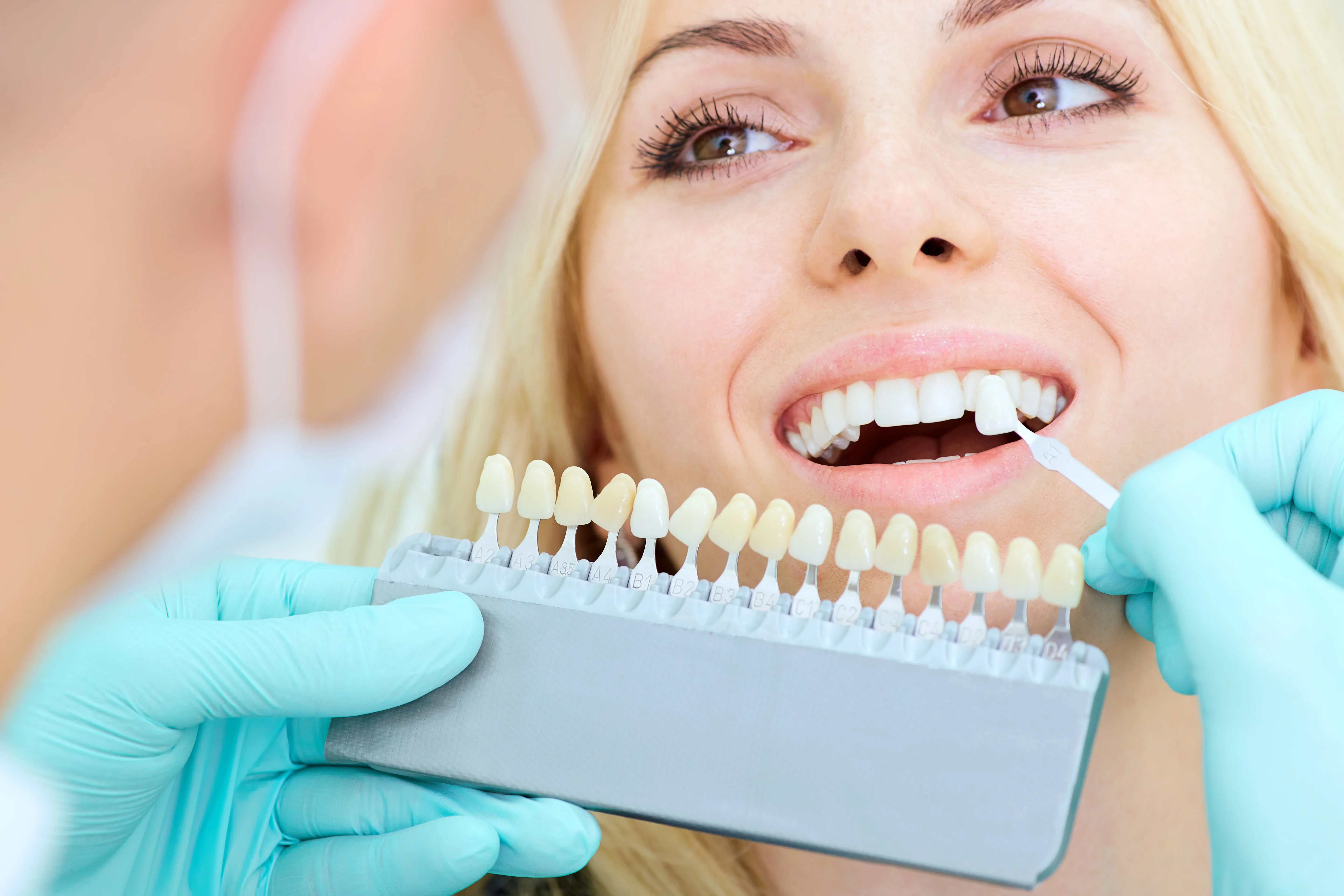 Teeth Whitening in Mumbai for a Brighter, Confident Smile