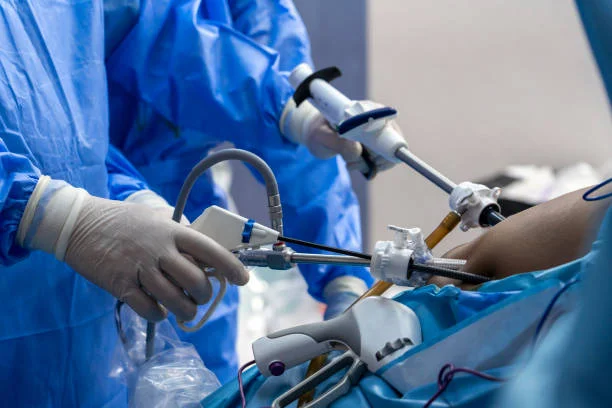 How Minimally Invasive GI Surgery Is Transforming Care