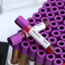 HbA1c Test Price in Lahore Cost, Normal Range, Procedure and Results