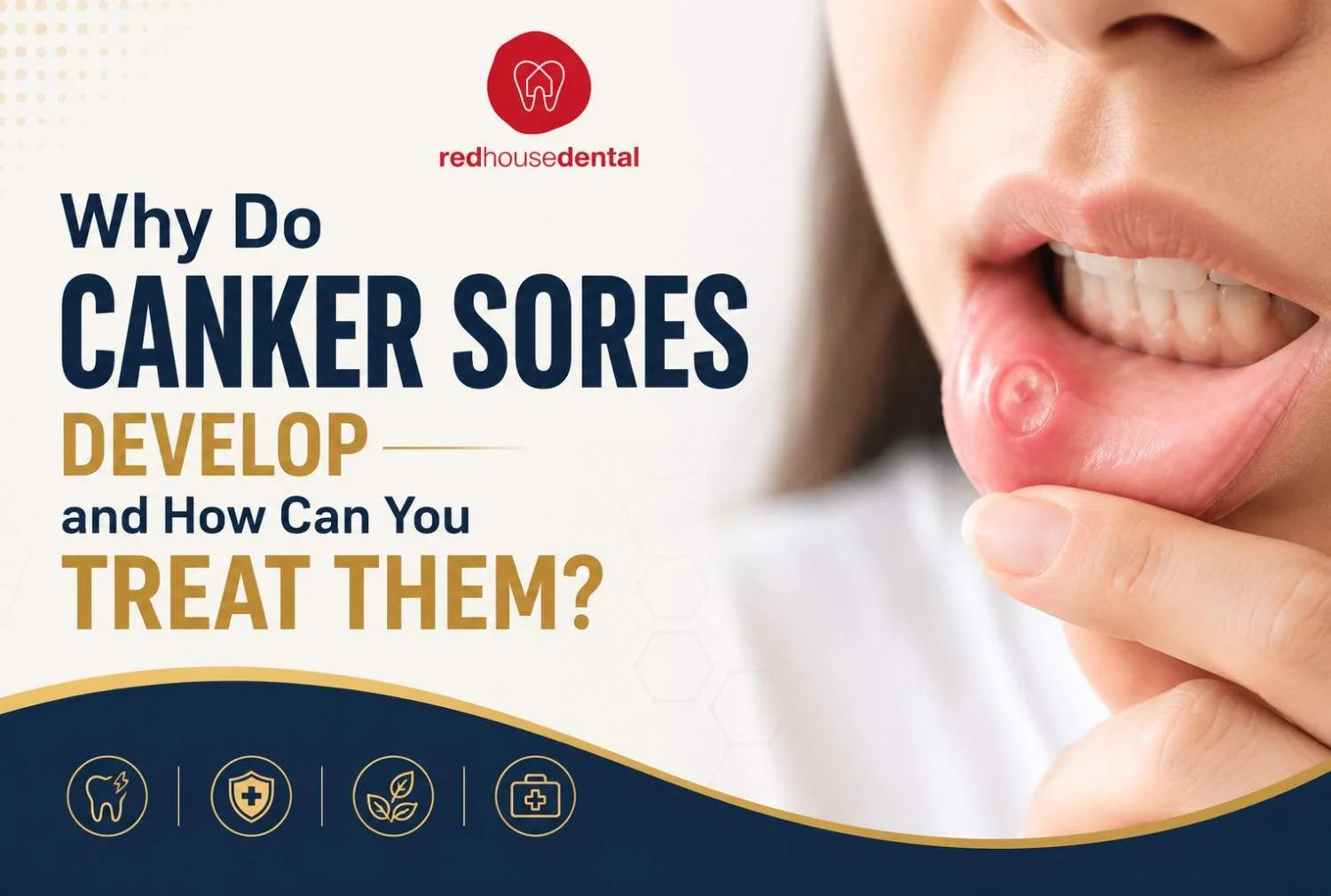 Canker Sores: Common Causes, Helpful Remedies, and When to Get Care