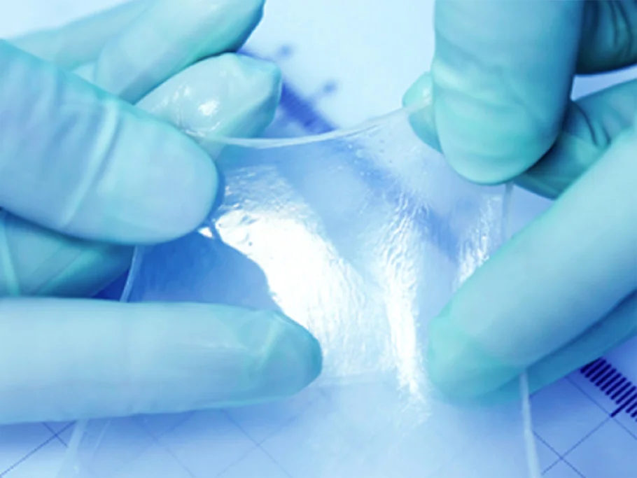 Amniotic Wound Grafts: A Practical Approach to Advanced Wound Management