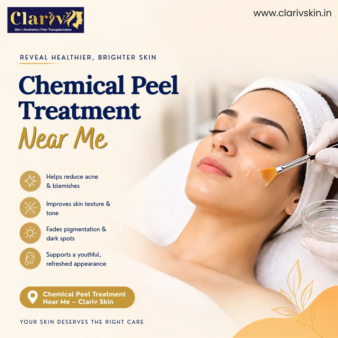 Chemical Peel Treatment in Shanthipura: Does It Work for Melasma?