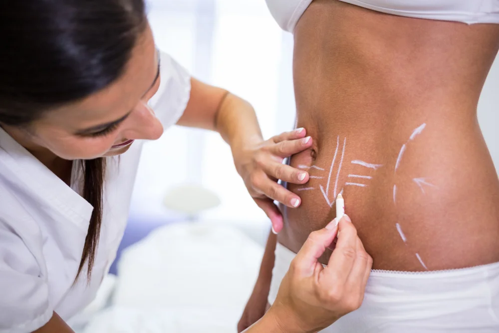 What to Look for When Choosing a Liposuction Surgeon in Jaipur