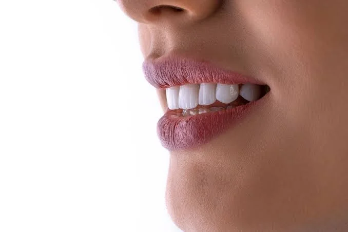 Tooth Implants in Sydney: What to Expect During the Procedure