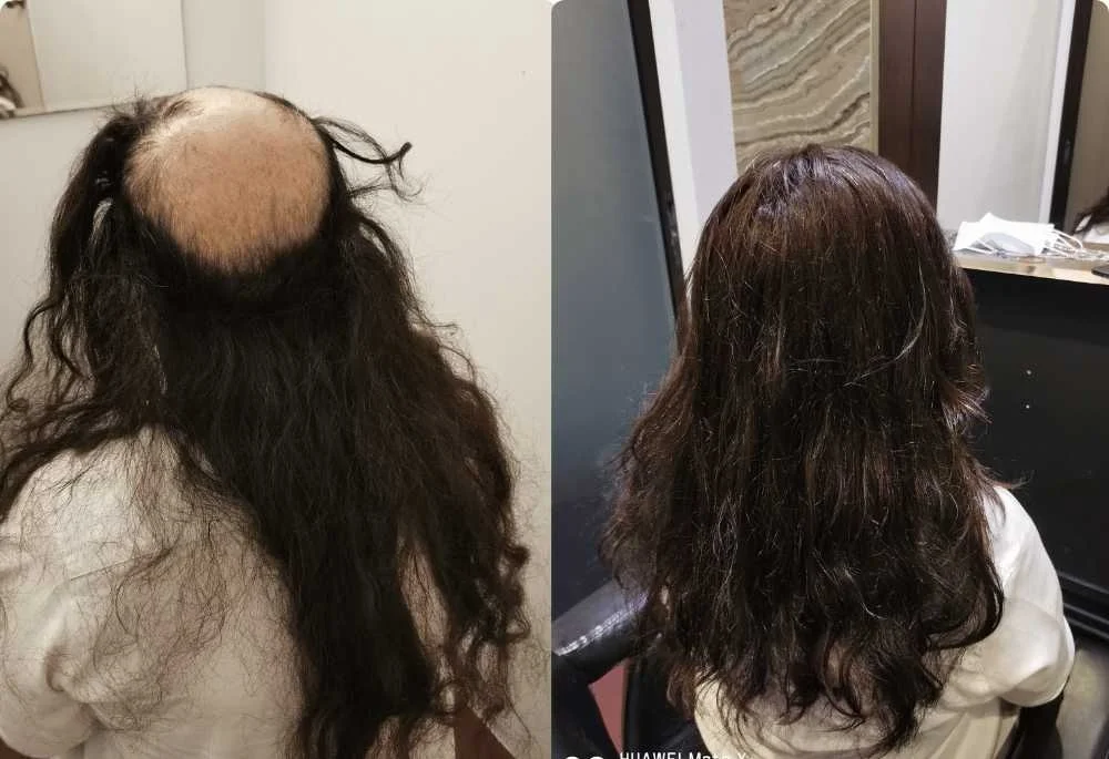 hairspec